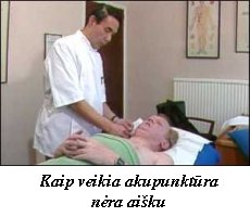 Akupunkt�ra