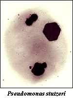 Pseudomonas stutzeri